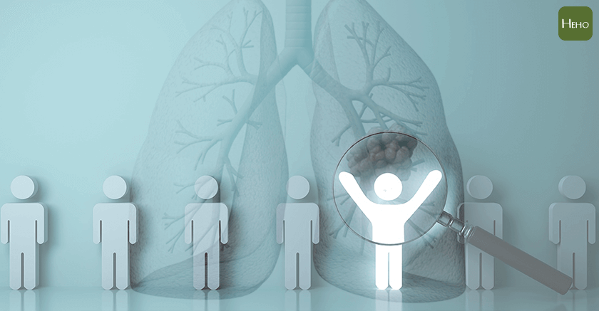 肺癌7大高風險族群