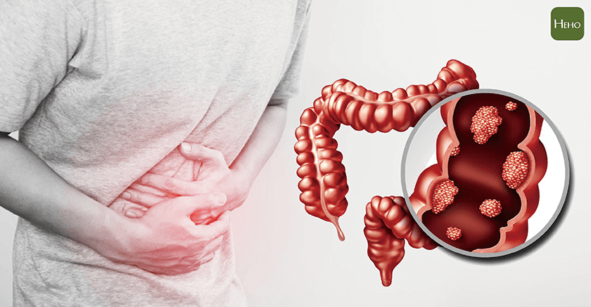 istock 照片檔 ID:807096116 照片檔 ID:877269344