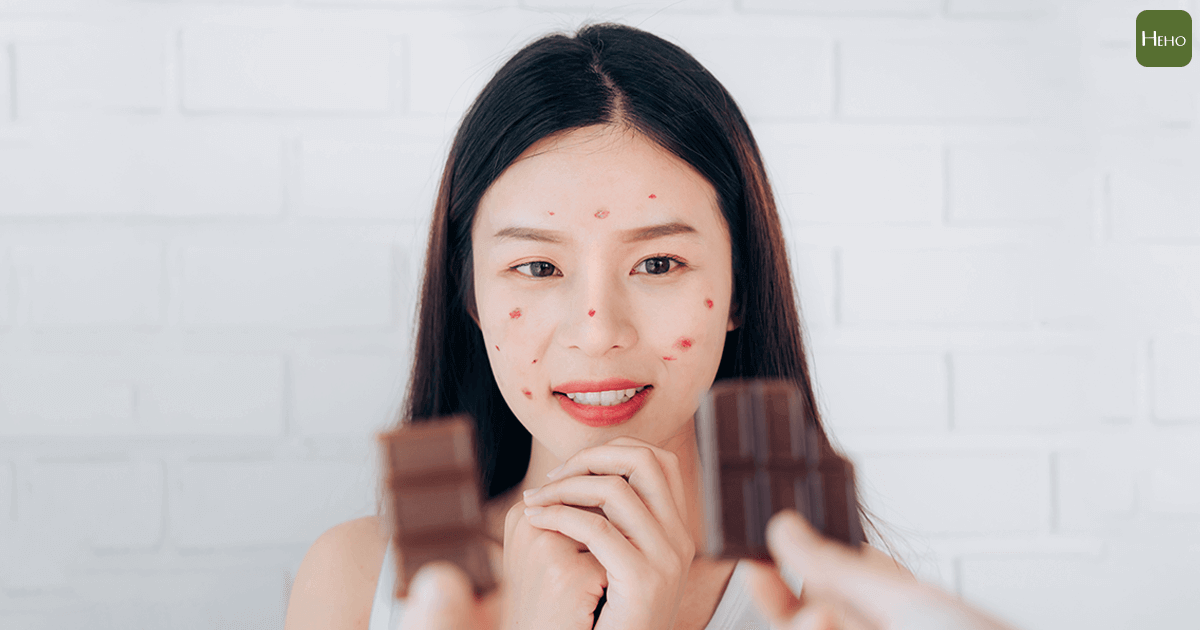 巧克力、牛奶是致痘幫兇？改善膚質應該這麼吃！