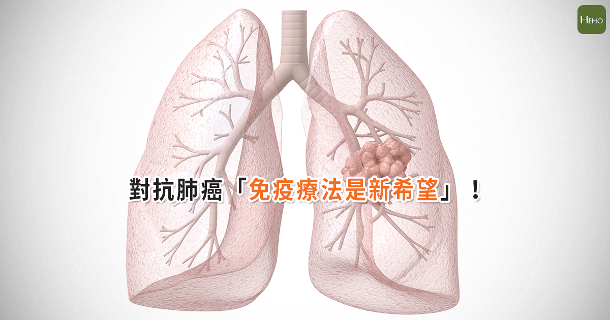 肺癌-01