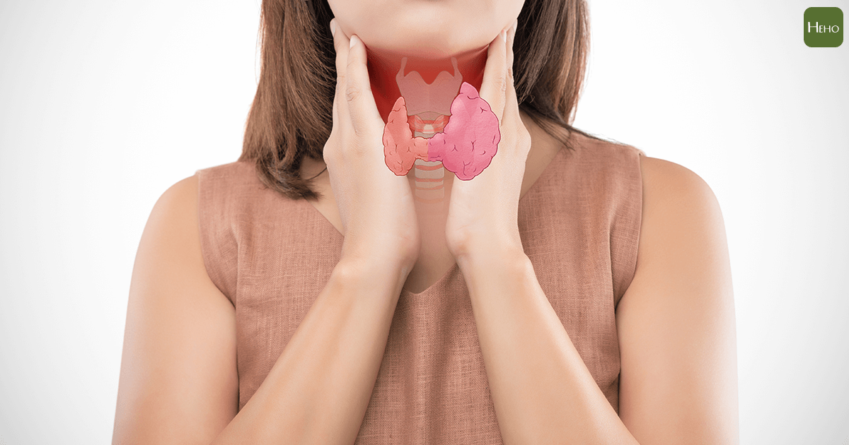 照片檔 ID:913575244