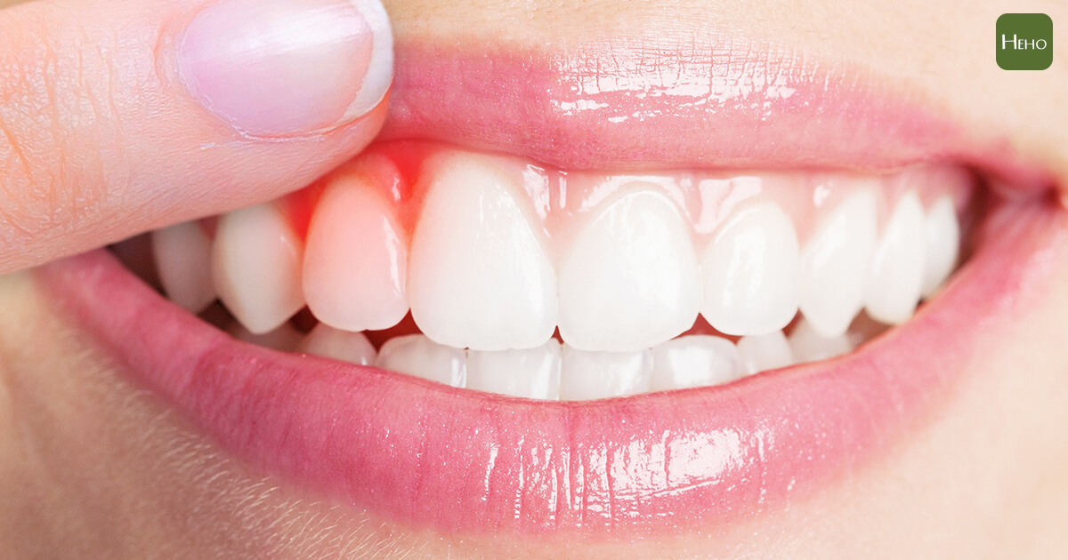 缺牙不補恐賠上咀嚼能力！治療前先評估：你適合做植牙呀？