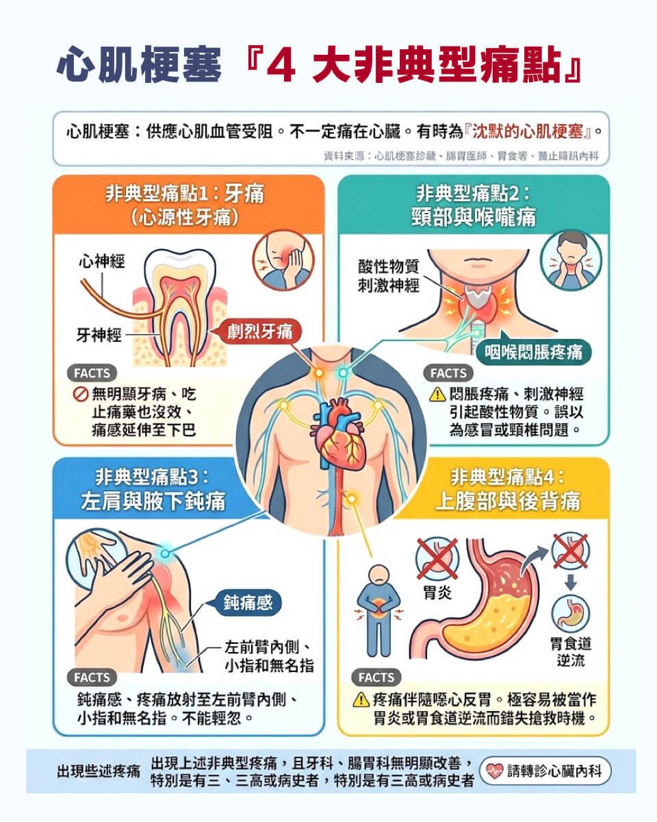 牙痛、肩膀痛竟是心臟在求救?心肌梗塞 4 個「非典型部位」一次看懂