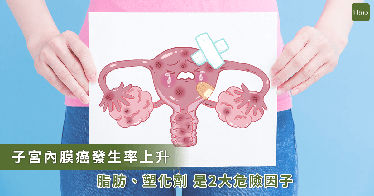 20191209-子宮內膜癌