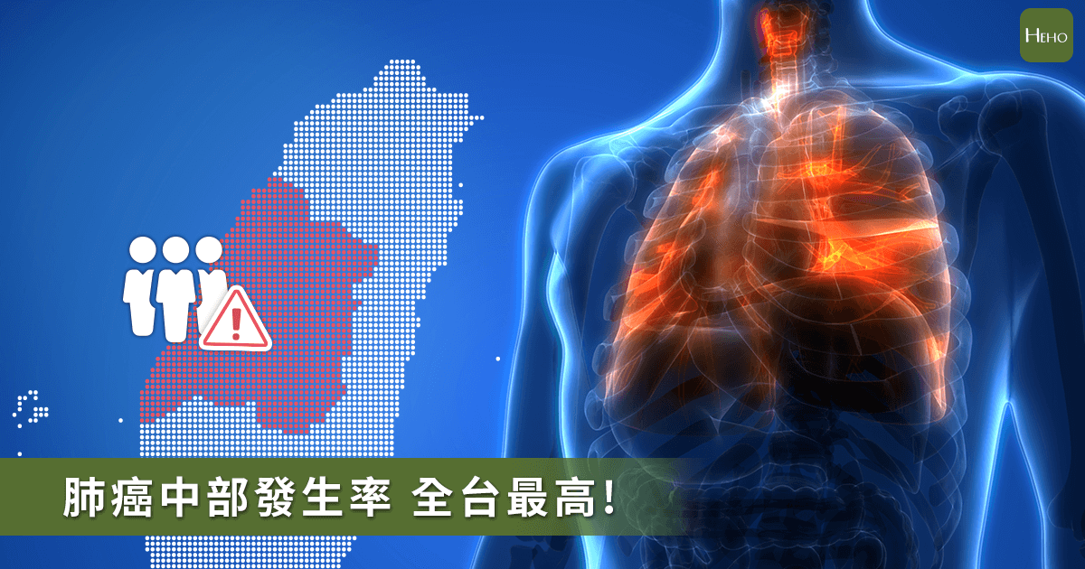 20200109-肺癌