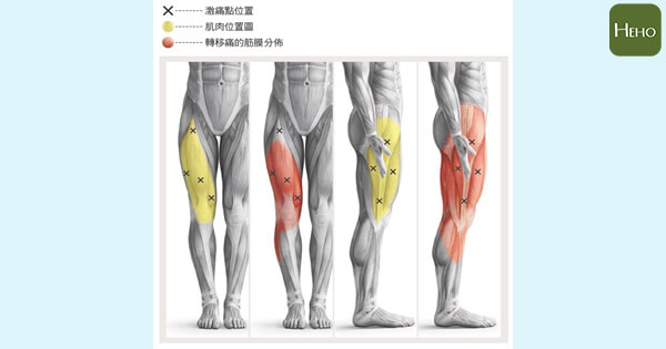 膝蓋痛也可能是肌肉發炎,1 招瑜珈伸展操緩解不適!