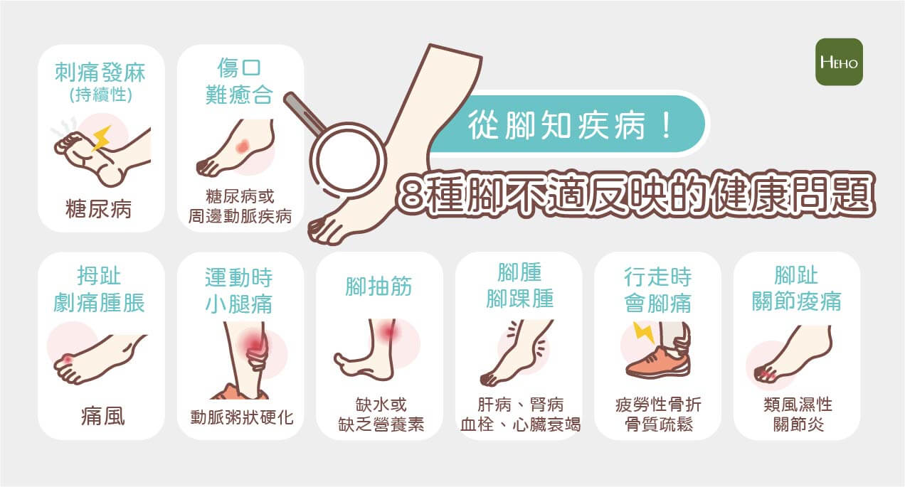 【Heho微動畫】盤點8種腳部不舒服可能的身體徵兆！