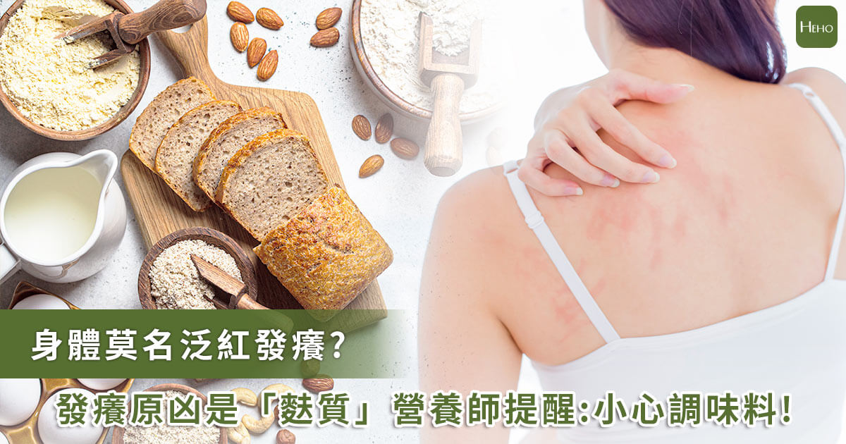 20220412 身體發癢泛紅是麩質惹禍？營養師：調味料要注意！3招無麩質飲食可改善