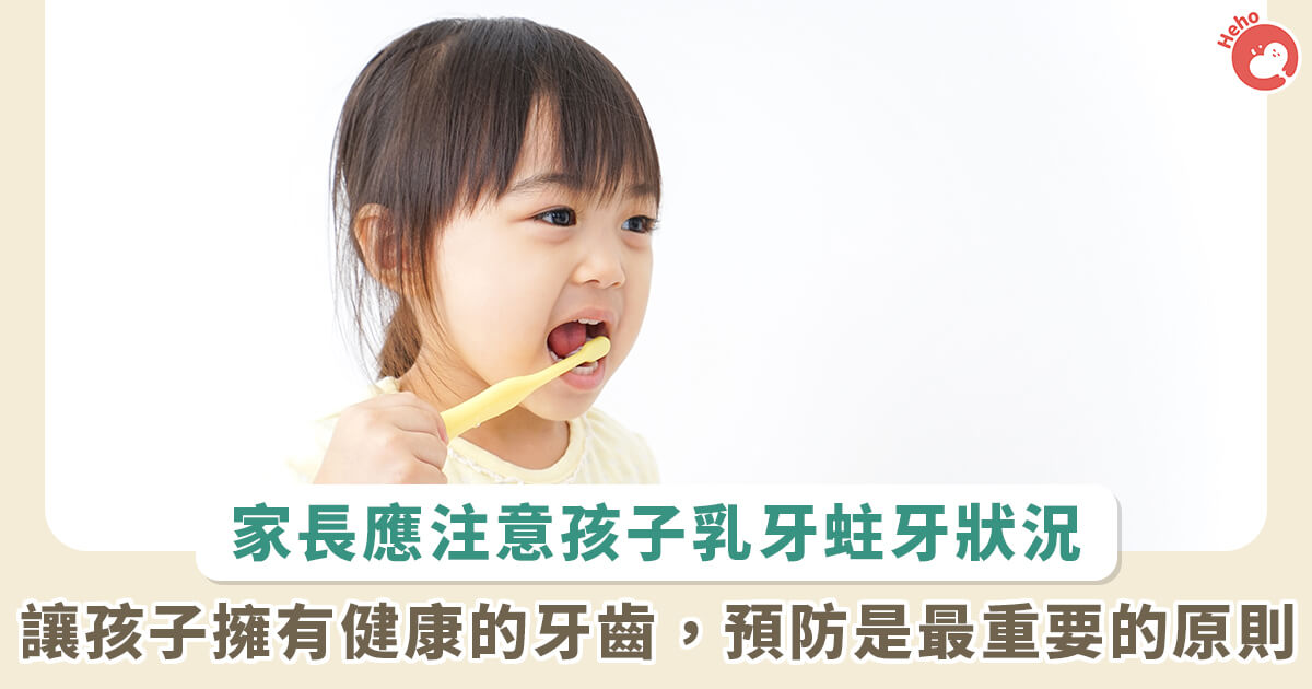 20221129_預防勝於治療！避免乳牙蛀牙 日常生活可做「這些事」督促孩童_