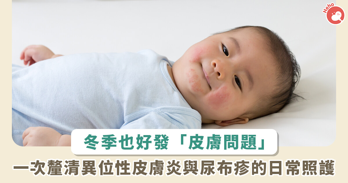 20230104_冬天嬰幼兒好發皮膚問題！異位性皮膚炎、尿布疹可以這樣保養