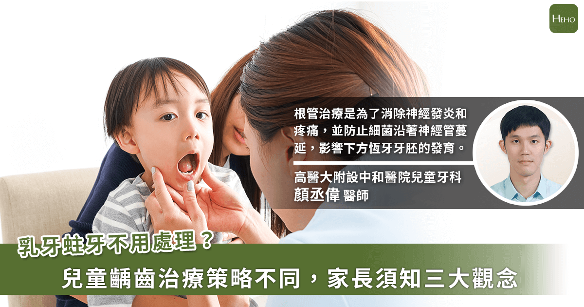 20230112_乳牙蛀牙不用處理？兒童齲齒治療策略不同，家長須知三大觀念-2
