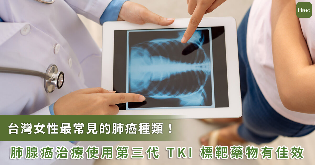 20230315_台灣女性最常見的肺癌種類 肺腺癌治療使用第三代TKI標靶藥物有佳效