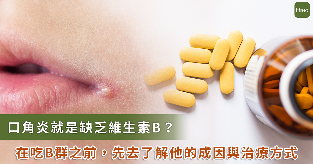 口角炎是缺乏維生素B？比起吃B群你更該知道的成因、治療方式