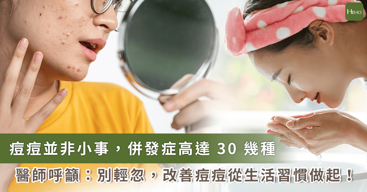 9 歲就長痘，青春痘竟與體質有關！皮膚科醫師建議：青春痘能根治 3 關鍵很重要