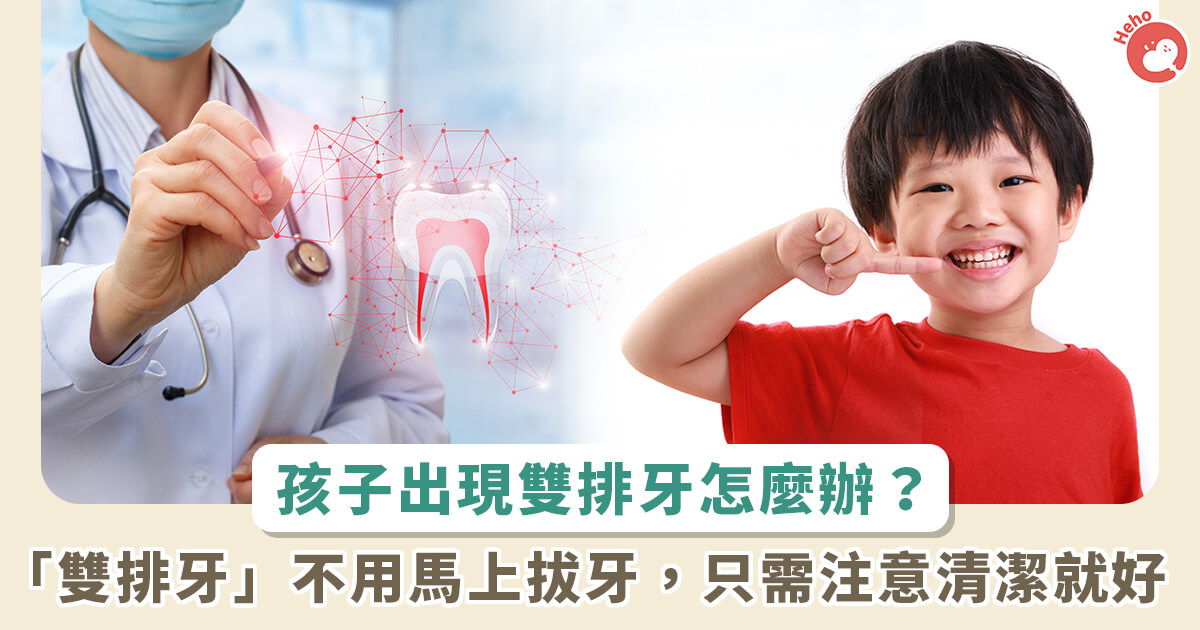 20230802_乳牙、恆牙同時在！兒童換牙出現「雙排牙」需不需拔牙？牙科醫觀念大解析