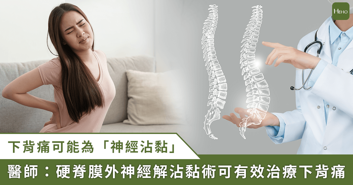 久站、久坐導致下背痛！止痛藥也無解的「神經沾黏」，微創手術可有效改善