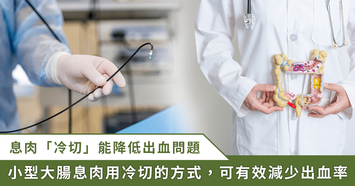 大腸息肉切除「 冷」、「熱」有別！ 研究證實冷切可減少出血率