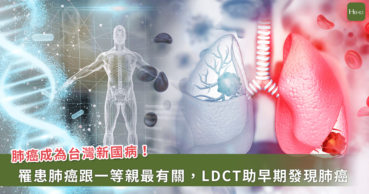 20240314_肺癌成為台灣新國病！罹患肺癌跟一等親最有關，LDCT助早期篩檢發現肺癌