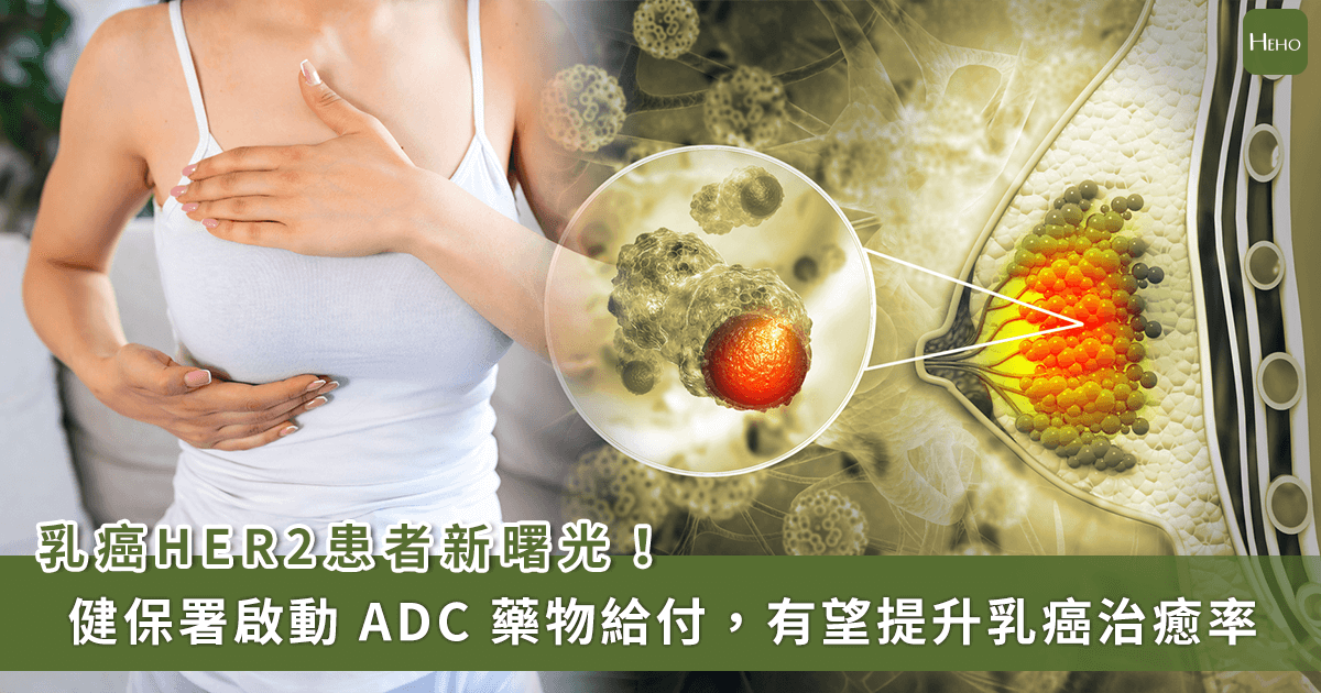 健保署啟動 ADC 藥物給付！HER 2 早期乳癌術後輔助治療減少復發率