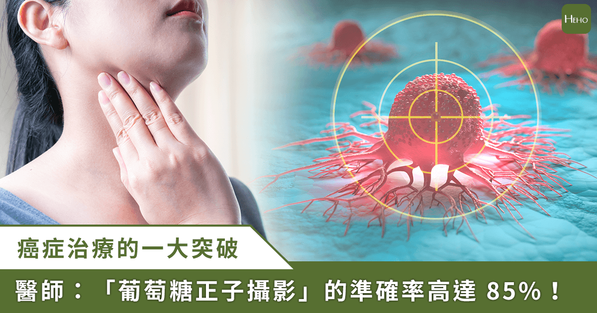20250424＿-癌症治療跨大步　正子攝影可準確評估唾液腺癌放射治療效果