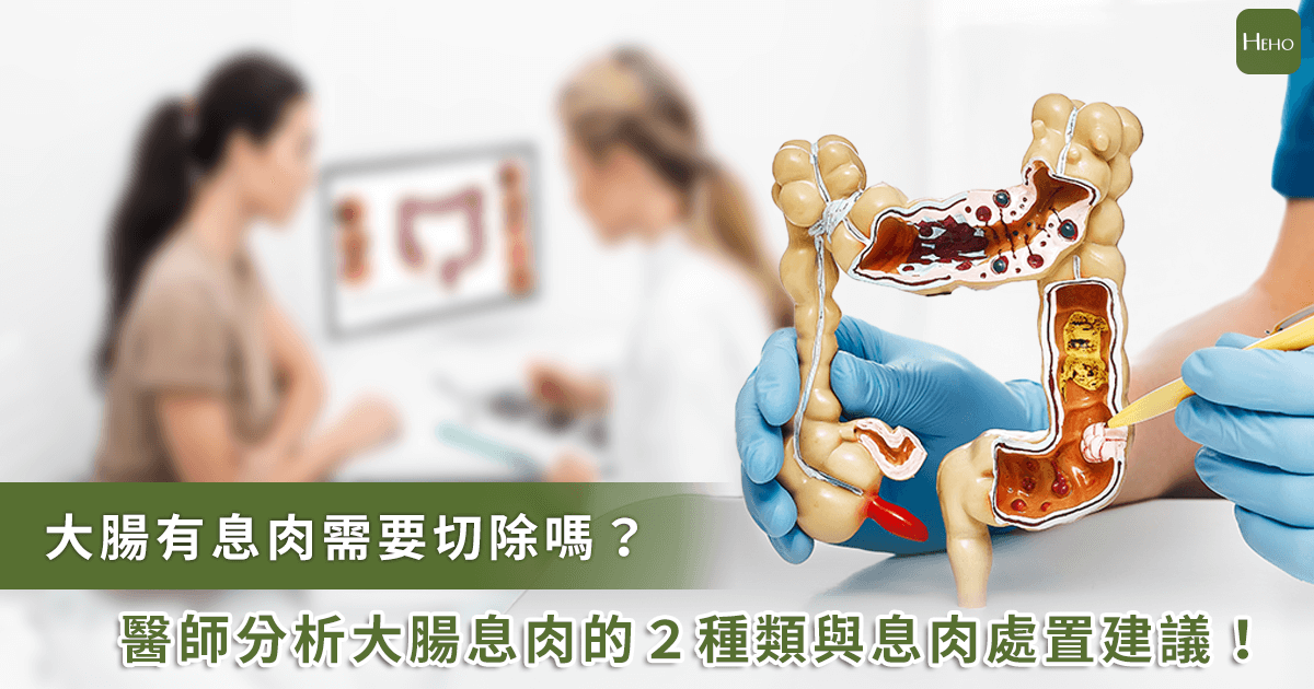 息肉一定要切嗎？腸胃權威醫師解析2種類差異
