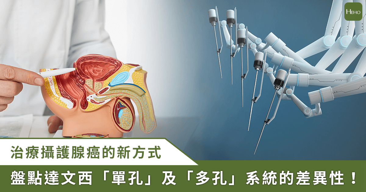 20250526_切除「攝護腺癌」新利器「達文西單孔-SP-系統」治療效果曝！