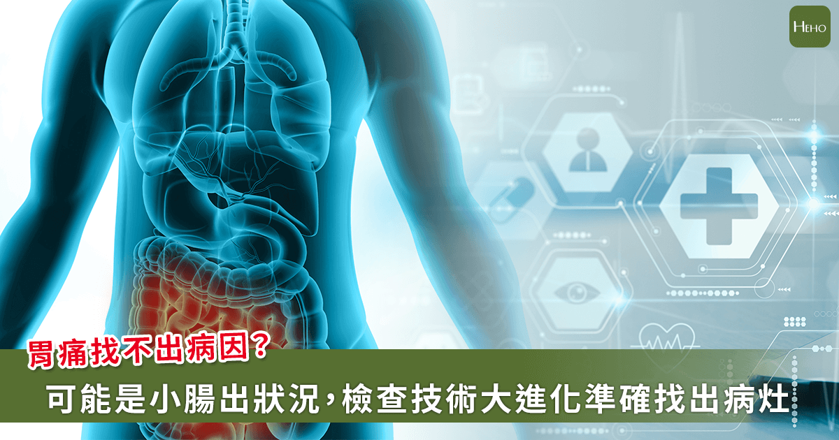 胃痛一直好不了？可能是胃鏡照不到的小腸出問題！