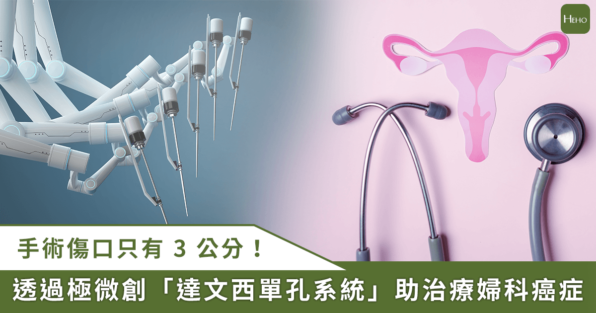 20250718_極微創「達文西單孔系統」傷口僅-3-公分！適用婦科癌症