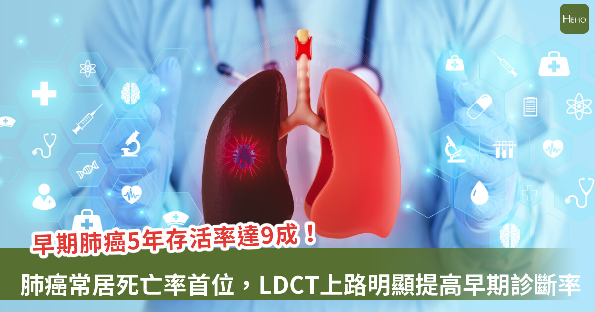 20250729-早期肺癌5年存活率達9成！肺癌常居死亡率首位，LDCT上路明顯提高早期診斷率，