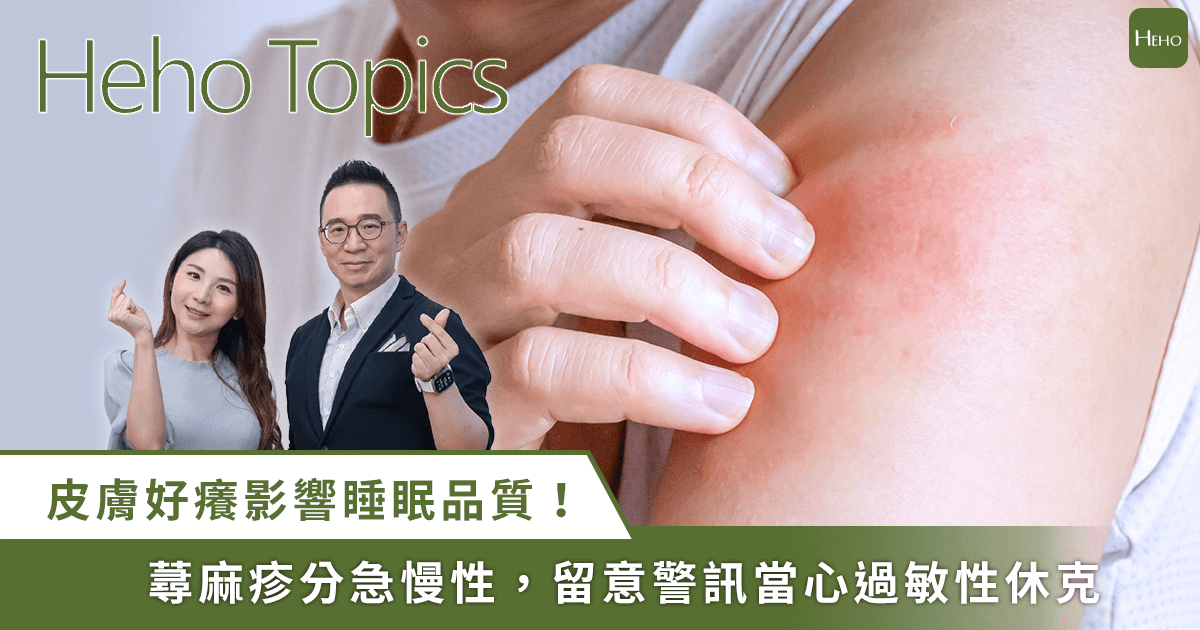 蕁麻疹讓你夏天又熱又癢睡不著？名醫黃耀立教止癢治療法＋避免急性休克