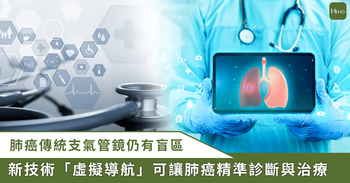 20250912_肺部病兆以傳統支氣管鏡恐有盲區！新技術「虛擬導航」-醫療費竟更省
