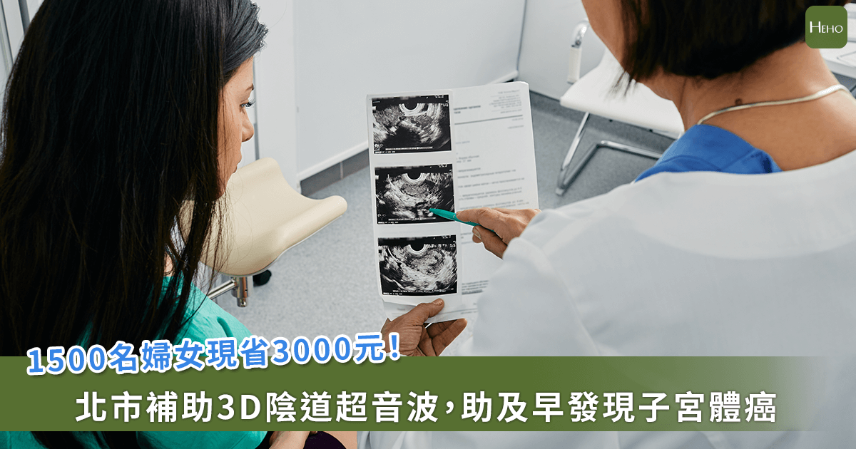 20250915-1500名婦女現省3000元！北市補助3D陰道超音波，助及早發現子宮體癌
