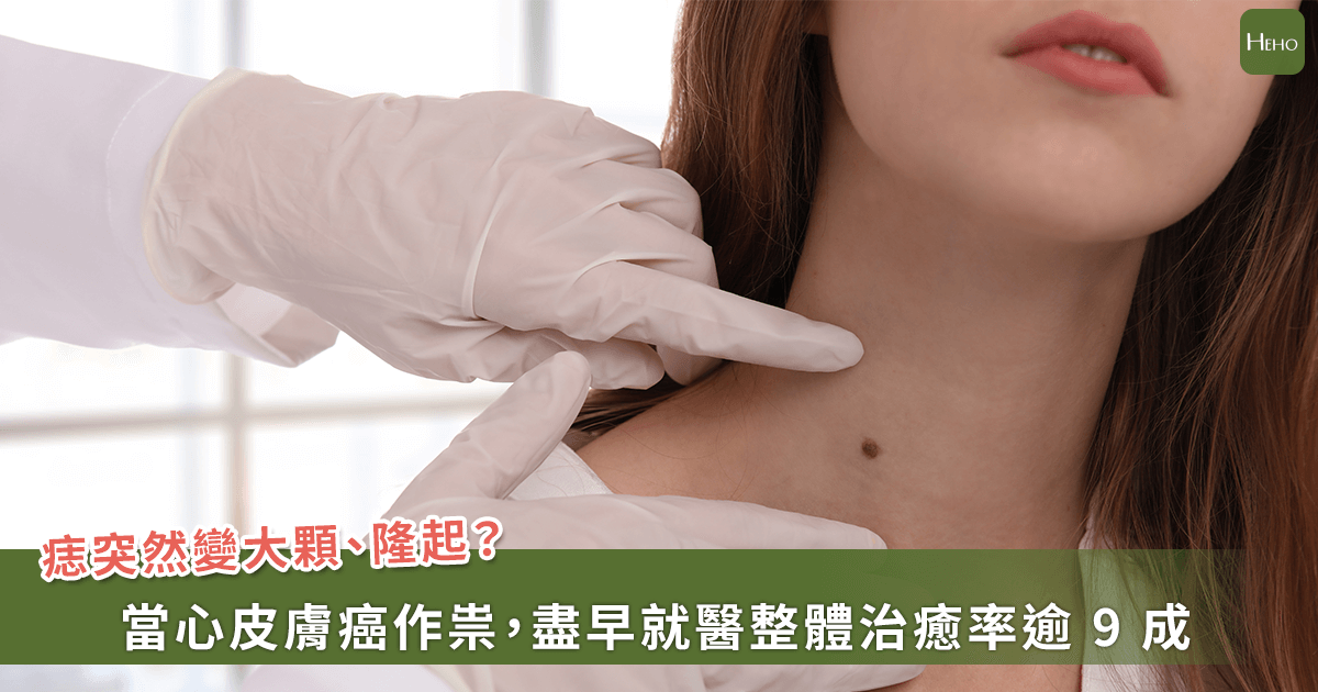20250919-痣突然變大顆、隆起？當心皮膚癌作祟，盡早就醫整體治癒率逾 9 成