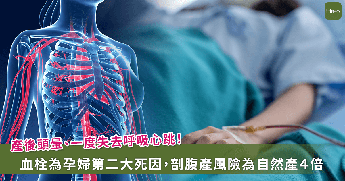 20251013-產後頭暈、一度失去呼吸心跳！血栓為孕婦第二大死因，剖腹產風險為自然產４倍