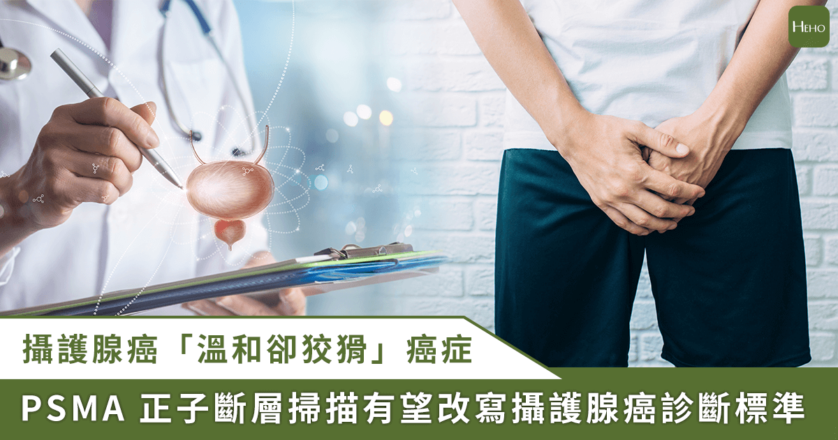 20260203＿攝護腺癌「溫和卻狡猾」手術後-PSA-指數上升常找不到病灶？PSMA-正子掃描緩解復發恐懼