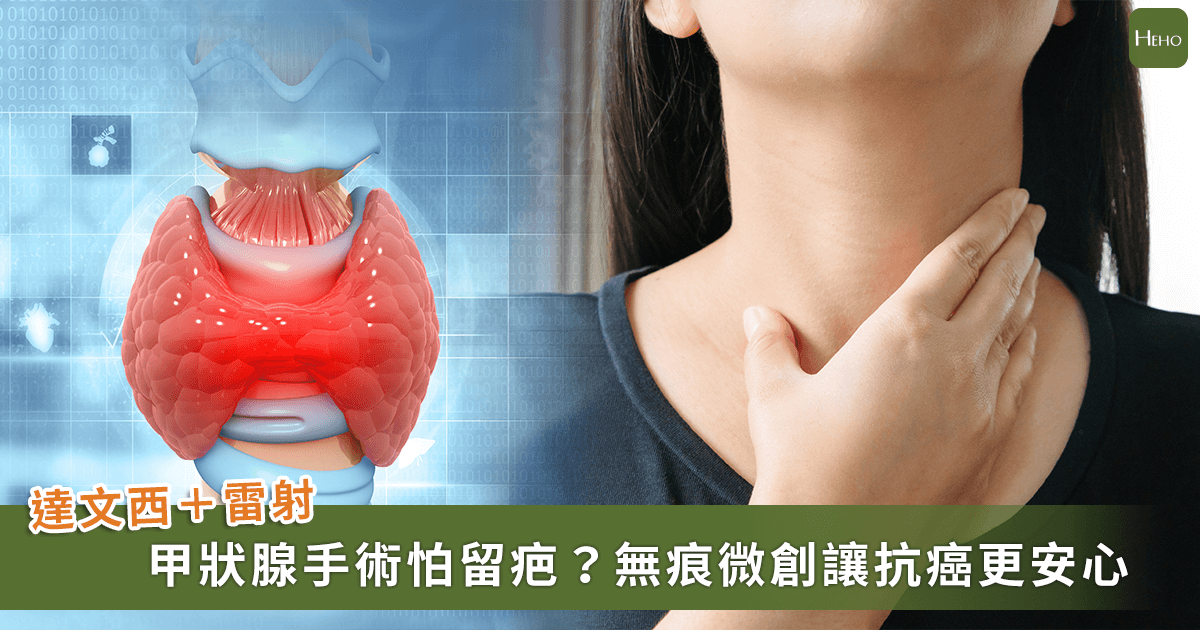 260204甲狀腺留疤