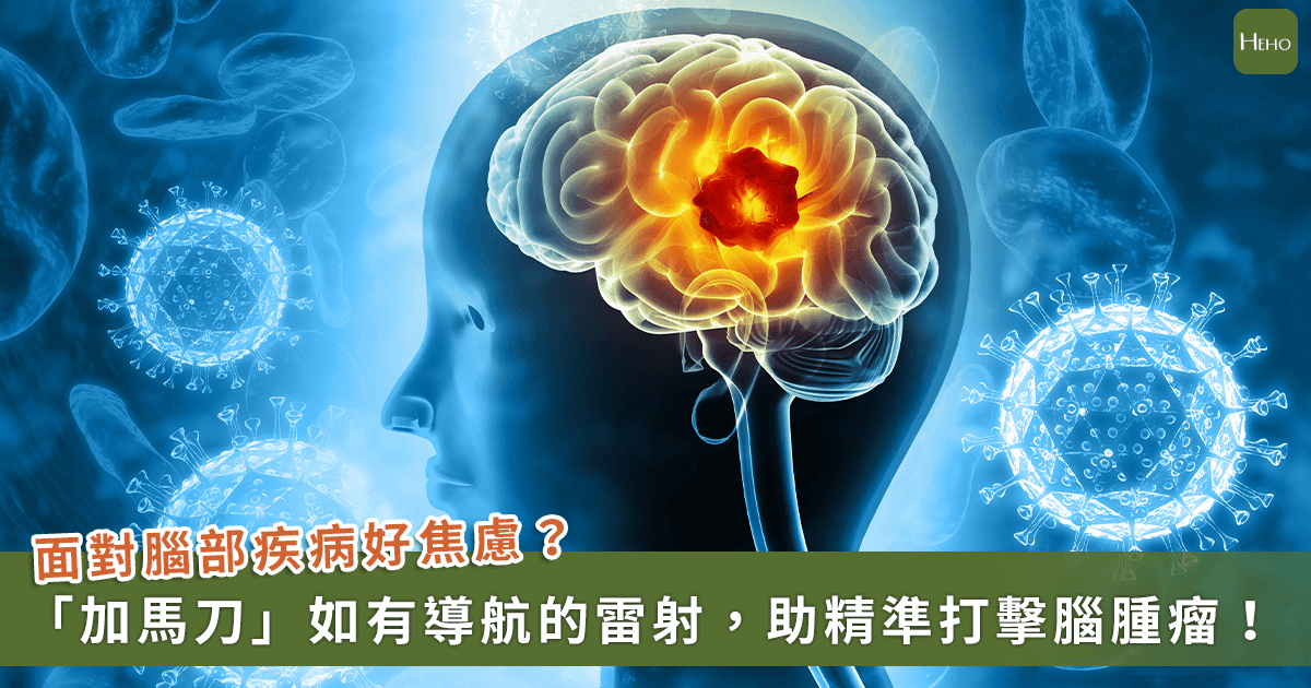 20260211＿改寫「腦瘤治療」新頁！「加馬刀」是什麼？免開顱、無傷口竟可以讓腫瘤萎縮