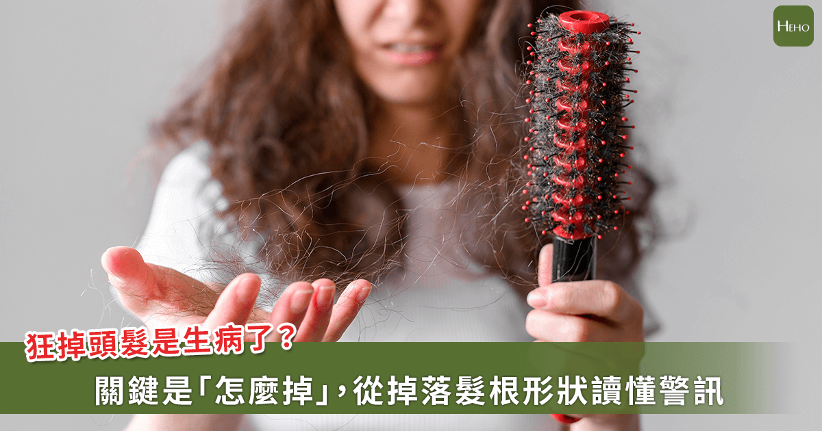 掉髮多就是禿頭危機？趙昭明醫師教你3秒拉髮實驗分辨正常還是警訊