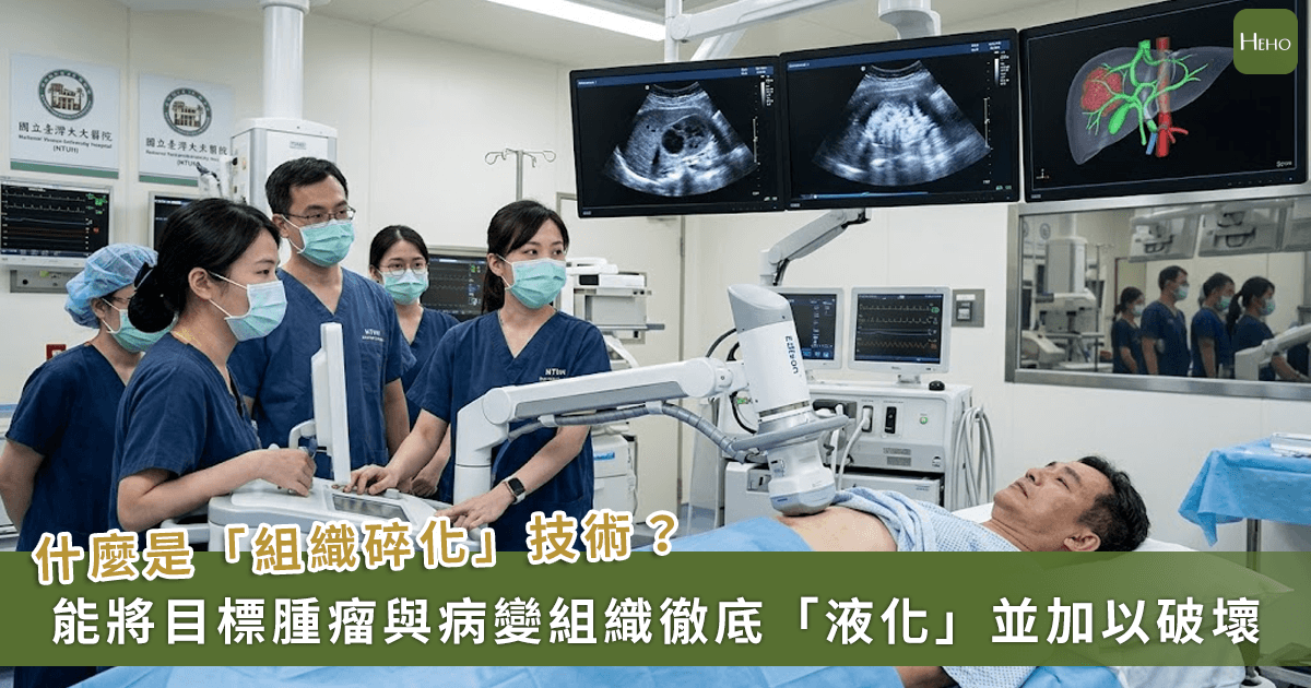 20260519_抗癌大突破!TFDA-首度核准「碎化刀」-台大醫院引進開啟無創治癌新時代 20260519_抗癌大突破!TFDA-首度核准「碎化刀」-台大醫院引進開啟無創治癌新時代