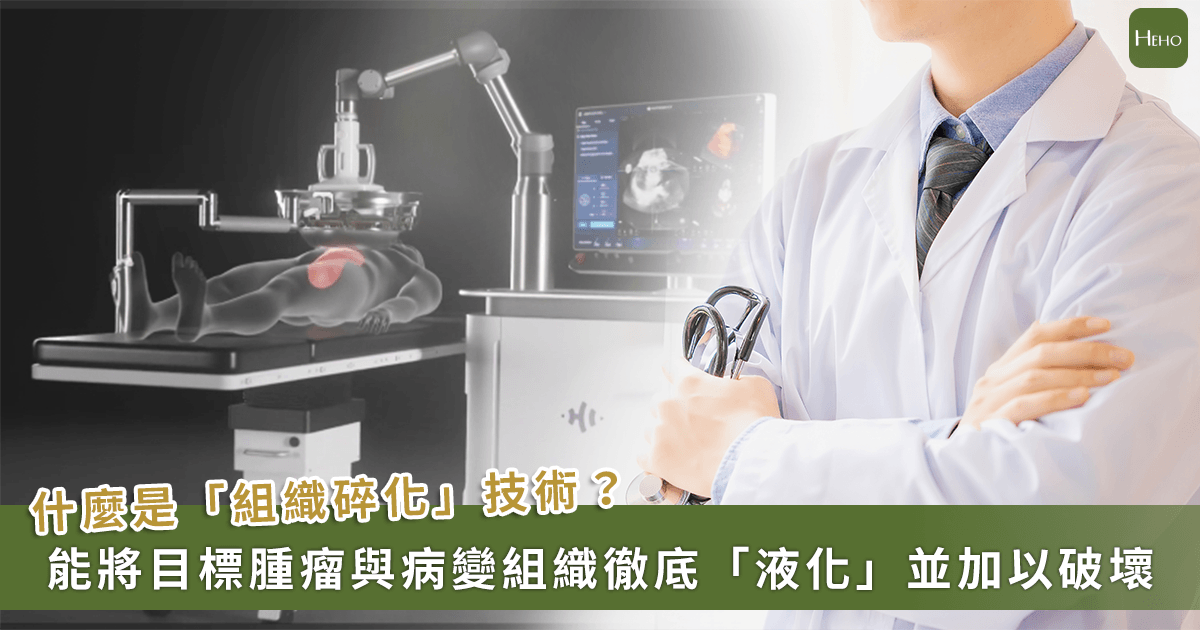 20260519＿抗癌大突破！TFDA-首度核准「碎化刀」-台大醫院引進開啟無創治癌新時代